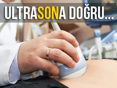 Ultrasona son