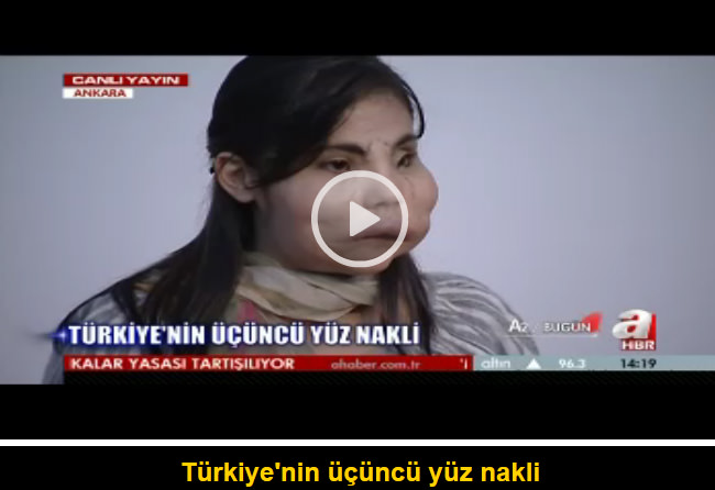 Yeni yüzü ile kameralar karşısında