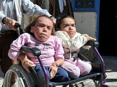 Doktorlar 3 yıl yaşar dedi ama...