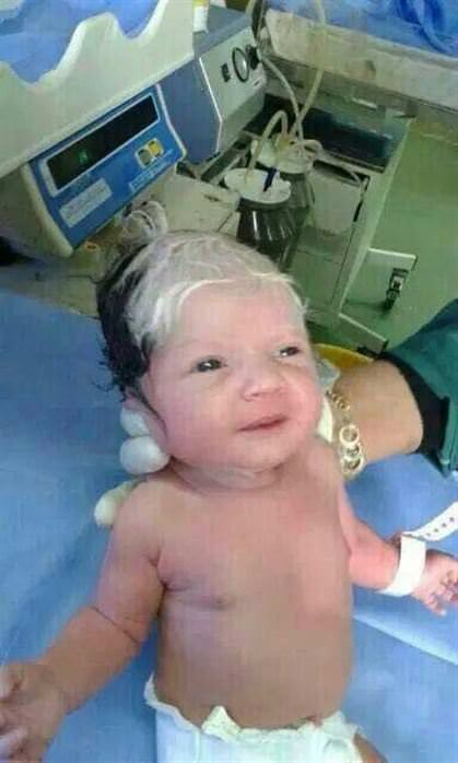 Siyah beyaz saçla doğdu