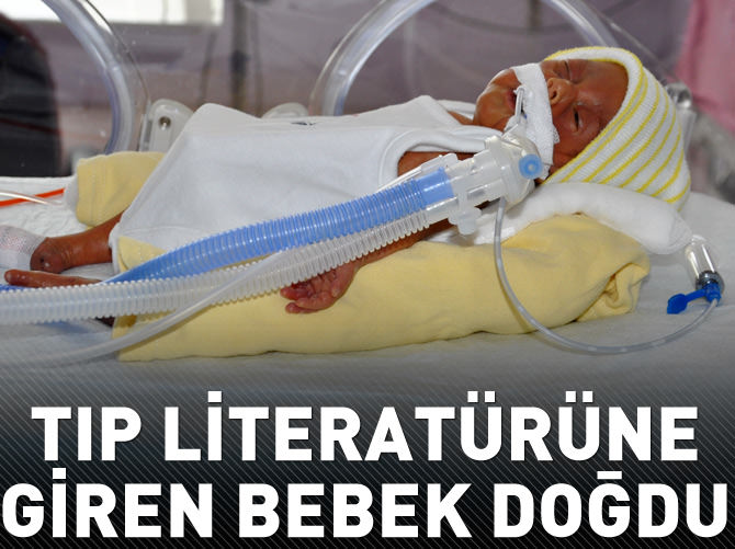 Tıp literatürüne giren bebek doğdu