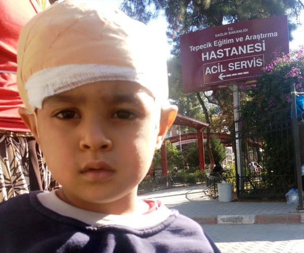 Kafasına taş düştü, hayatı kurtuldu! - 1