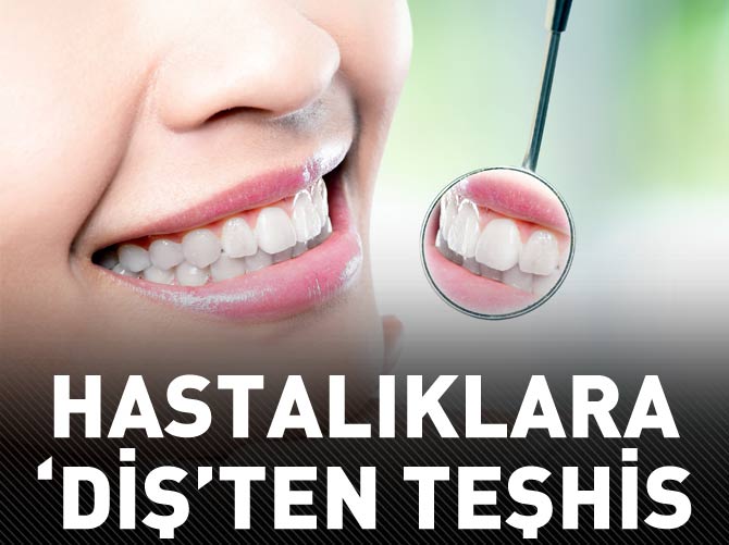 Hastalıklara 'diş'ten teşhis