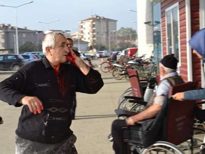 Spiral makinasıyla yüzünü kesti