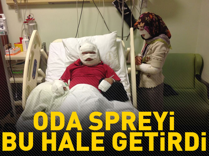 Oda spreyi bu hale getirdi