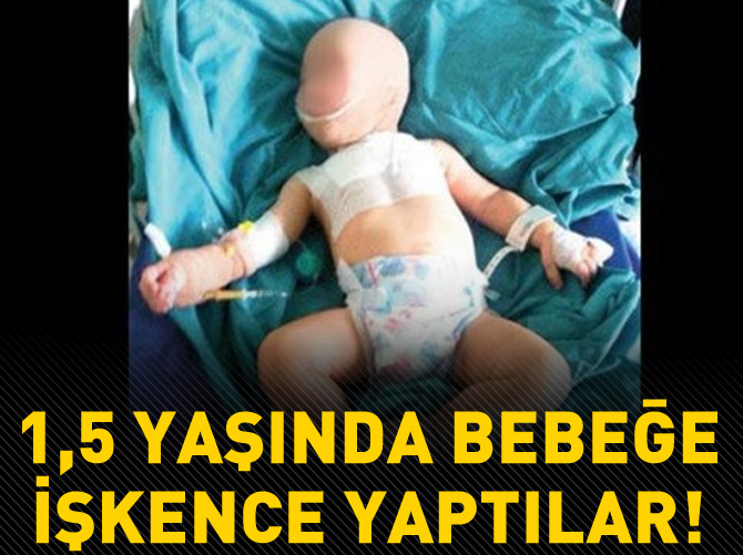 1,5 yaşında bebeğe işkence yaptılar