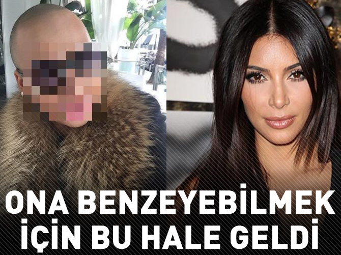 Ona benzeyebilmek için bu hale geldi