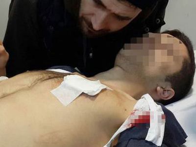 Facebook yüzünden bıçaklandı