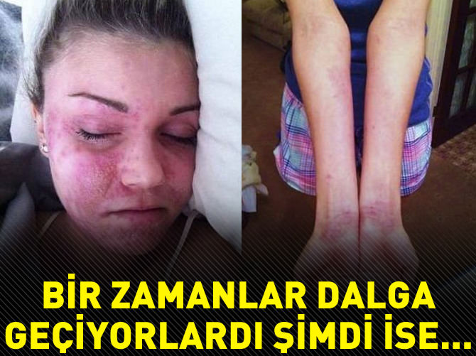 Alay edenlere inat güzellik kraliçesi oldu!