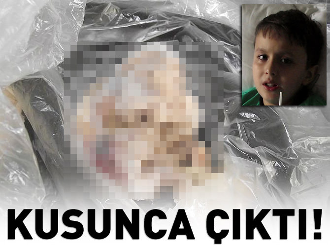 Boğazında gazlı bez unutulan minik Timuçin ölümden döndü