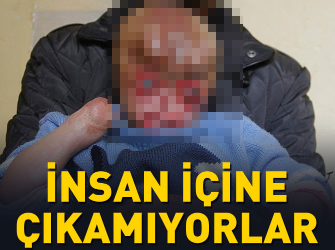 O daha 4 yaşında insan içine çıkamıyor