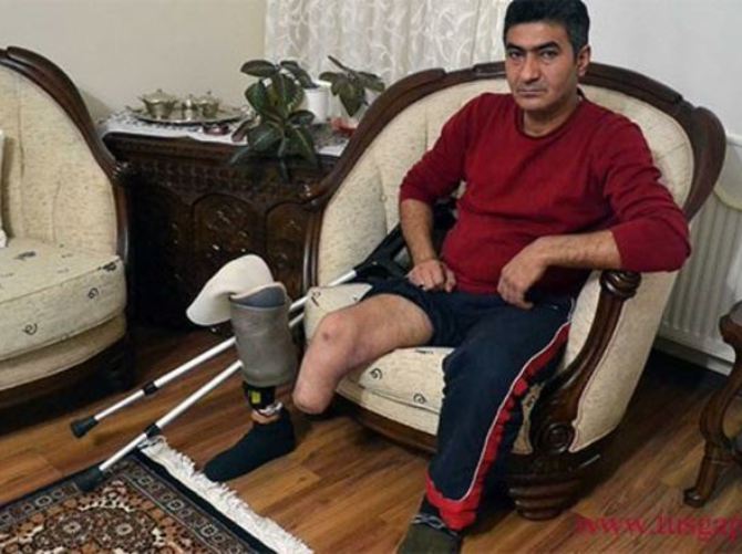 Gaziye protez bacak icrası şoku