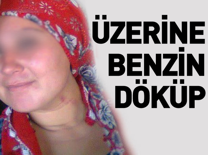 Evden kaçan kardeşini benzin döküp yaktı!