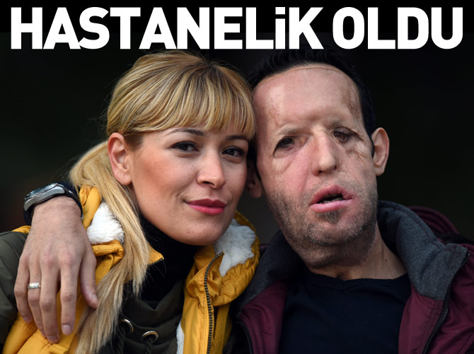 Yüz nakli olan Recep Sert hastanelik oldu
