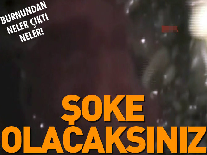 Burnundan tam 100 adet et yiyen kurt çıkarıldı!