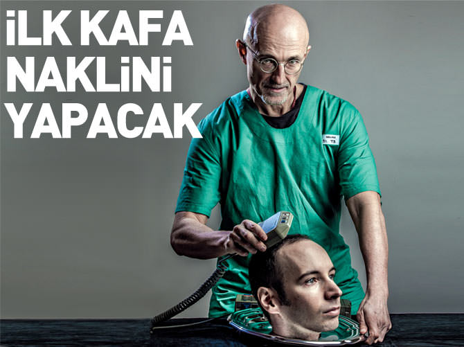 İtalyan cerrah dünyanın ilk kafa naklini yapacak