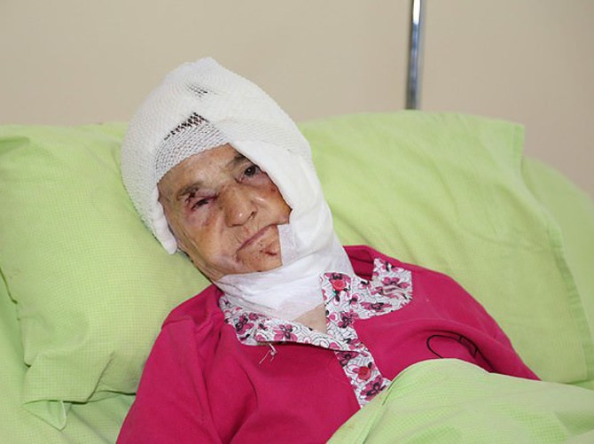 92 yaşındaki yaşlı kadına ayı saldırdı