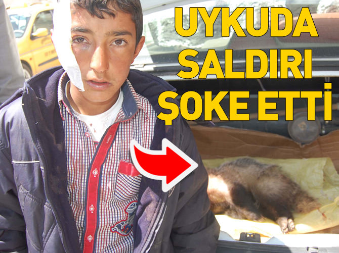 Uyurken porsuk saldırısına uğradı