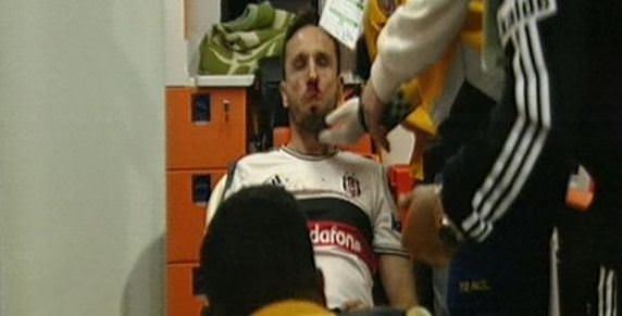 Tomas Sivok sakatlanarak oyundan çıkmak zorunda kaldı