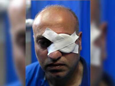İsrail askerleri Filistinli foto muhabiri gözünden yaraladı