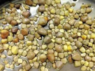 Böbreğinden 420 taş çıkarıldı