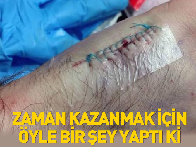 Zaman kazanmak için öyle bir şey yaptı ki..