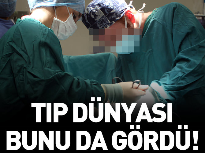 Bu da oldu: Üç kişi, bir böbrek!