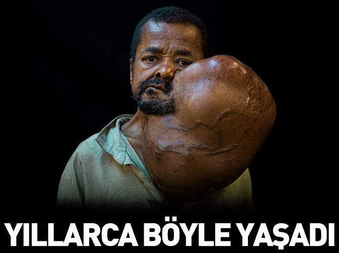 Yıllarca böyle yaşadı