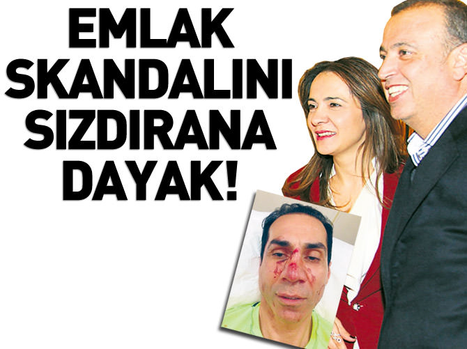 CHP'li İlgezdi'nin emlak skandalını sızdırdana dayak!