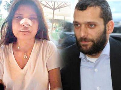 Melis Çakır, Özbizerdik'i şikayetten vazgeçti