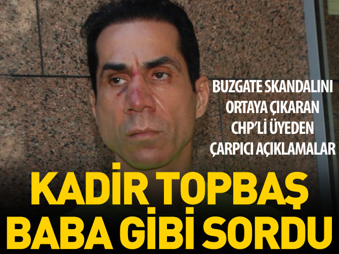 Kadir Topbaş baba gibi sordu