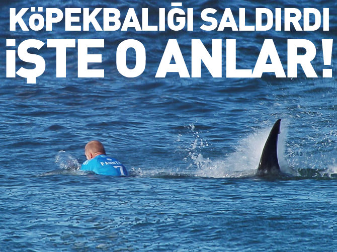 Şampiyon sörfçü köpekbalığı saldırısına uğradı