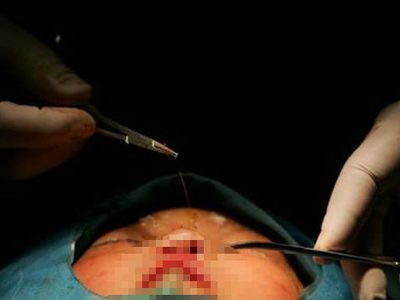 Çin: Doktor tarif etti, dedesi 2 günlük bebeği öldürdü