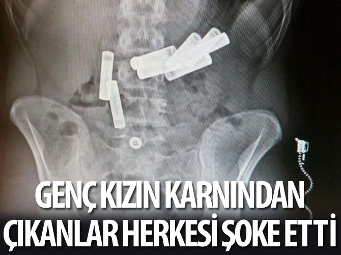 Düzce'de genç kız 8 pil yuttu