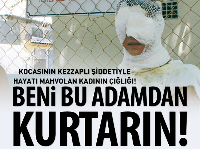 Kocasının kezzaplı şiddetiyle hayatı mahvolan kadının çığlığı!: Beni bu adamdan kurtarın!