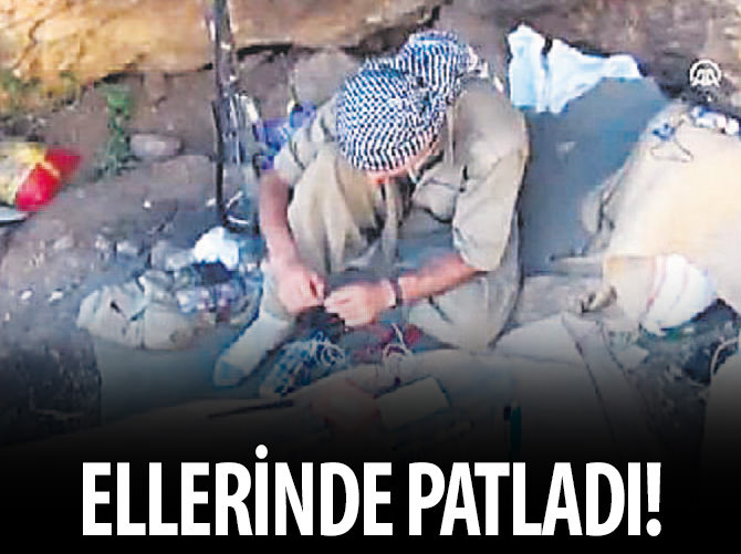 Ellerinde patladı