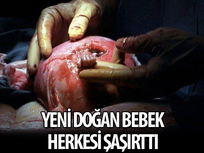 Yeni doğan bebek herkesi şaşırttı