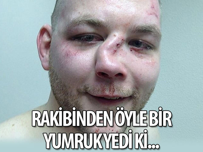 Dövüş sporcularının maç sonu halleri