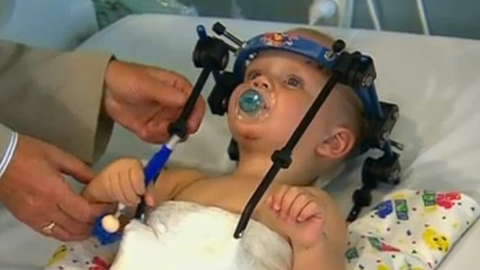 Başı kopan bebek kurtarıldı