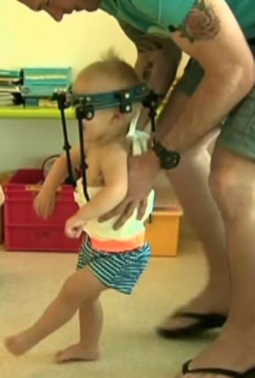 Başı kopan bebek kurtarıldı