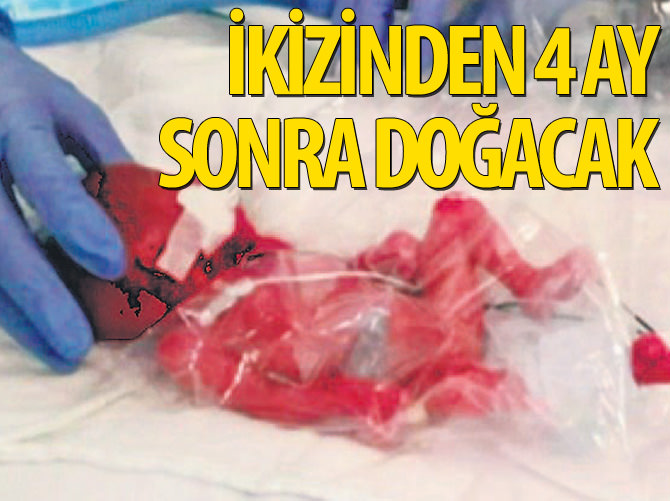 İkizinden 4 ay sonra doğacak