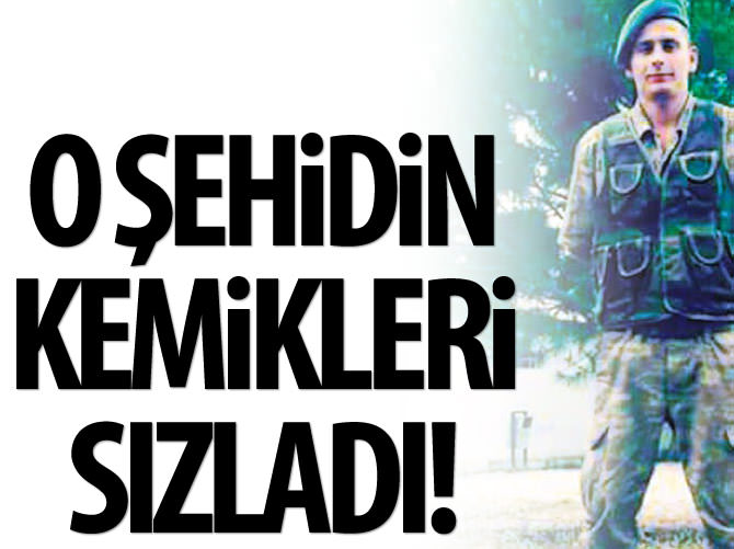 O şehidin kemikleri sızladı!