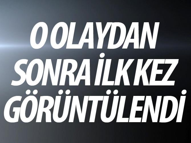 Asit kurbanı Y.K. olaydan sonra ilk kez görüntülendi