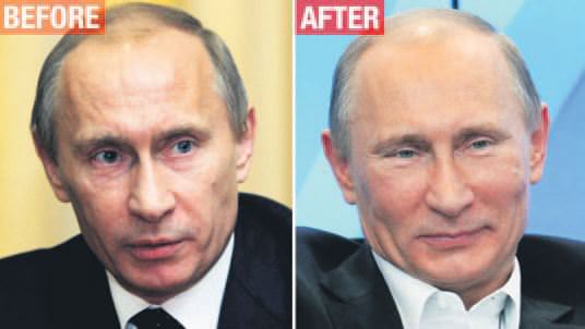 Putin’in koluna dikkat ettiniz mi?
