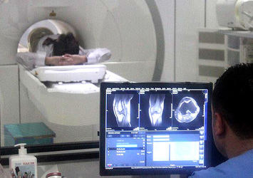 Prof. Dr. Bilen: Prostat kanserinde tanı eziyeti sona erdi