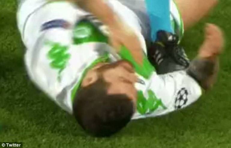 Wolfsburglu Vieirinha dişinden oldu! - 1