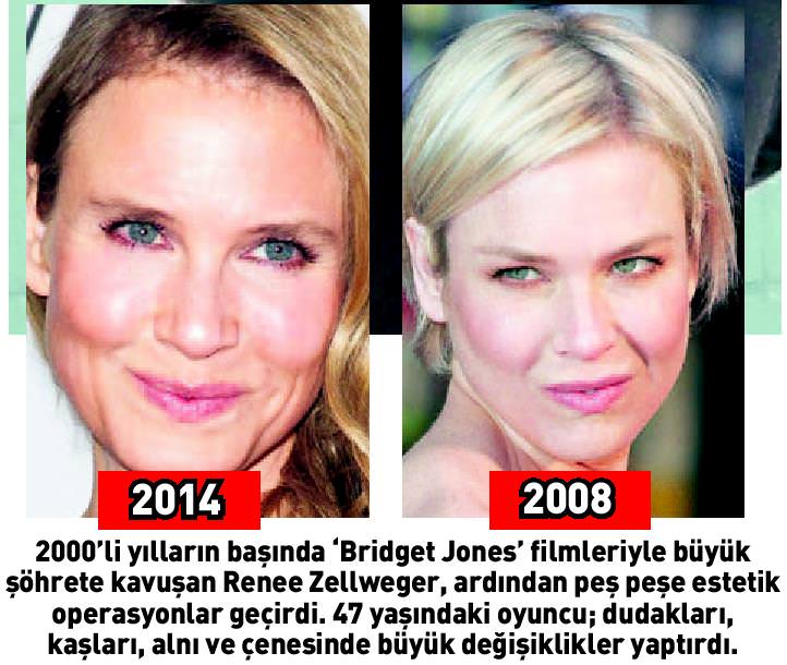 Renee Zellweger, yine yüzünü değiştirdi! - 1