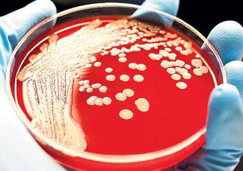 Yeni kâbus: Superbug