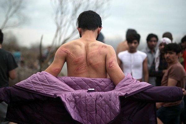 Son dakika: Vicdansız Yunan! Nazi kampını aratmayan görüntü - 2