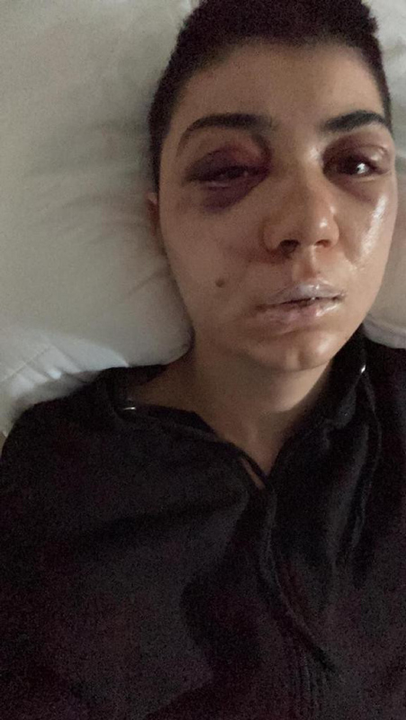 Beyaoğlu’nda kan şiddet: 23 yaşındaki kızı döve döve felç etti!